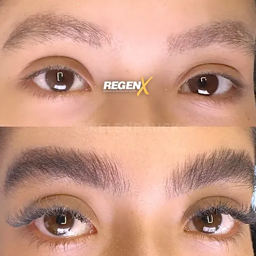 RegenX Sobrancelha (2)
