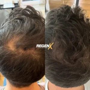Louise-Geertsen-Cabelo-B-18-06-2025-1-r7ls3zuow4dtuslfajwa7yinm47n33idhatmgxckgw