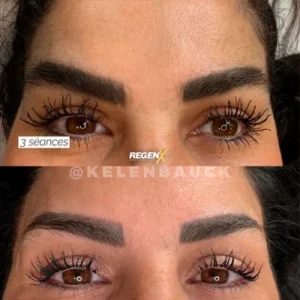 REGENX-SOBRANCELHA-KELEN-9-r4wt6me5ht0cdq6kj1mv6p3ana9xerxdzuooa4ih7k