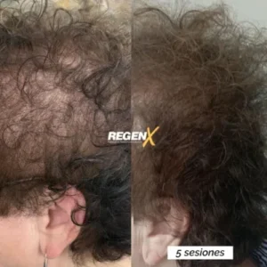 Stephanie-Bailly-Cabelo-B-18-06-2025-ESP-r7ls41qd9sgei0iozkpjcy1ksvydihpu5k4lfh9s4g